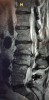 E1C27CEE-B1FF-498A-8FC5-F589F0165C70.jpeg (1.76 MiB) Viewed 5761 times My MRI, dated 10/07/20